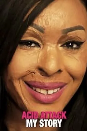 Acid Attack: My Story movie poster - Entertainment content
