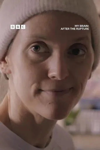 My Brain: After the Rupture movie poster - Entertainment content