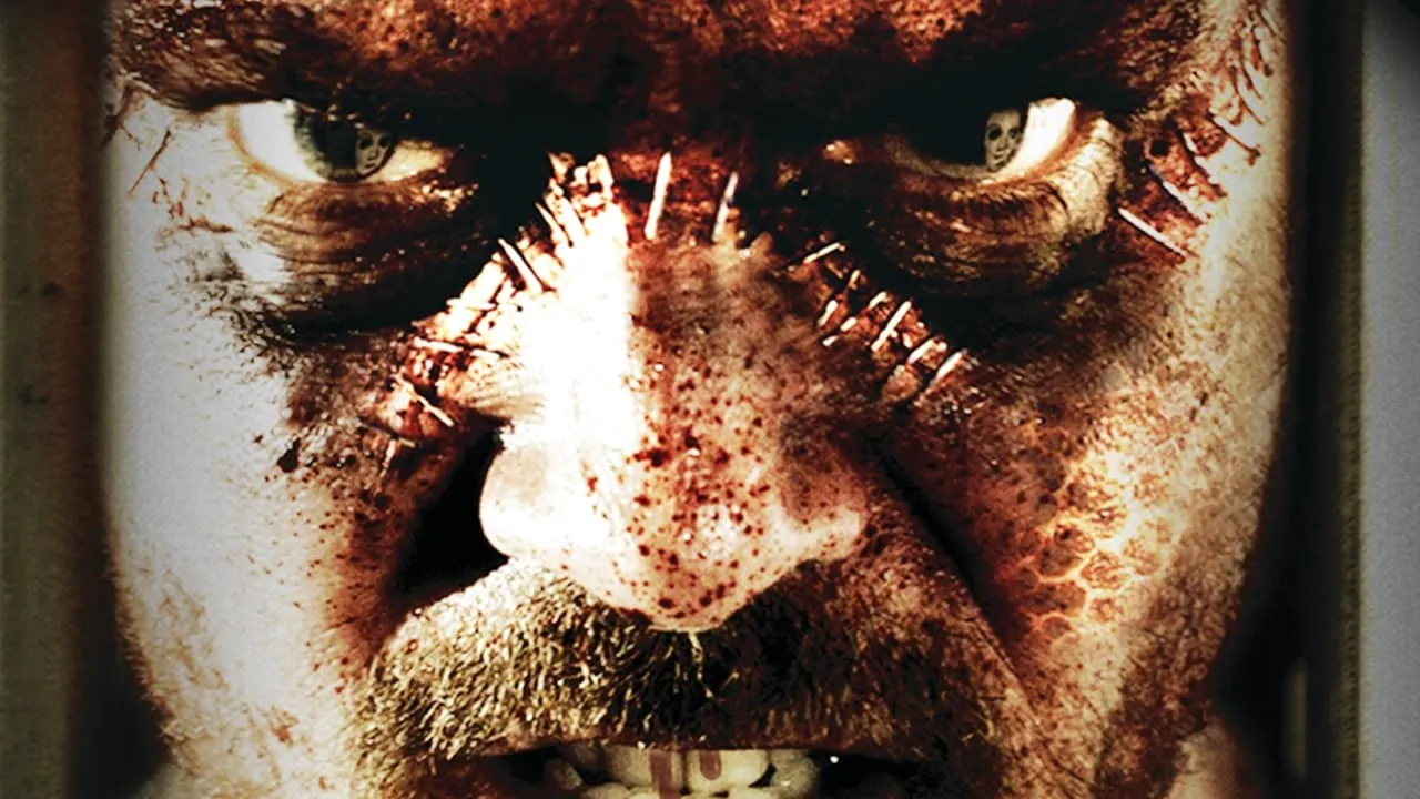 The Frankenstein Syndrome